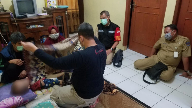 Pasien Hidrosefalus di Bedahan Dapat Pengobatan Terapi