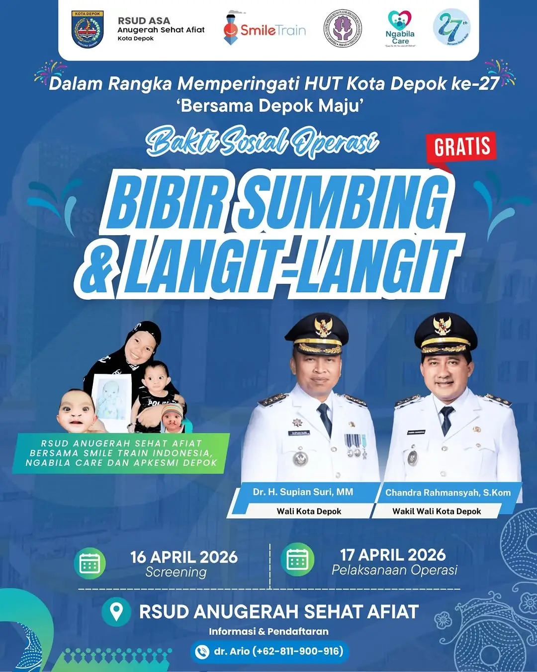 Sambut HUT ke-27 Depok, RSUD ASA Buka Operasi Bibir Sumbing Gratis: Ini Syaratnya