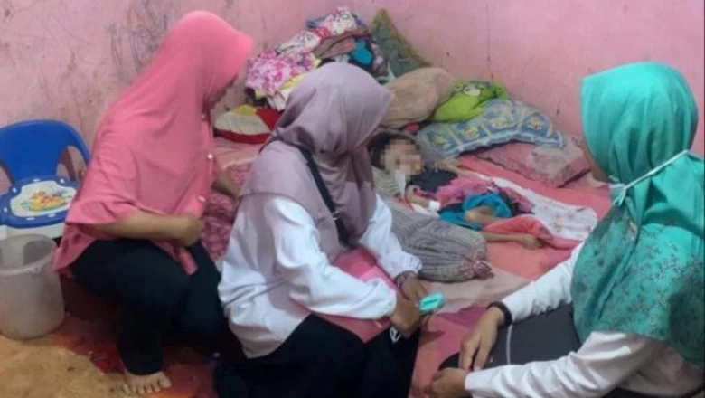 Dinkes Depok Terus Dampingi Anak Hedrosefalus di Krukut