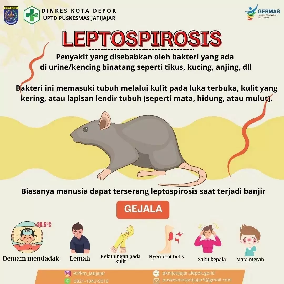 Puskesmas Jatijajar Minta Warga Waspadai Leptospirosis Saat Musim Hujan
