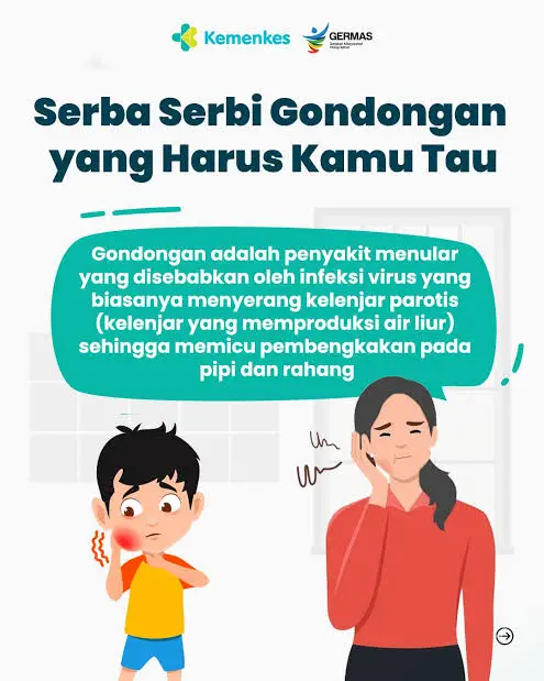Yuk Kenali Penyakit Mumps, Bisa Dicegah dengan Vaksin MMR